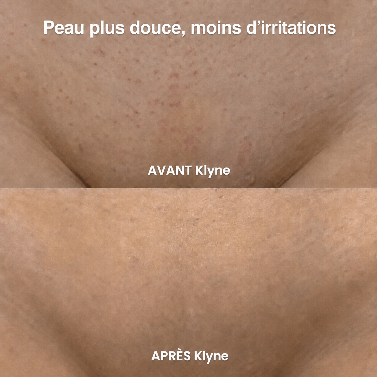 KLYNE™ – Rasoir 2-en-1 Sans Douleur