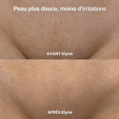 KLYNE™ – Rasoir 2-en-1 Sans Douleur